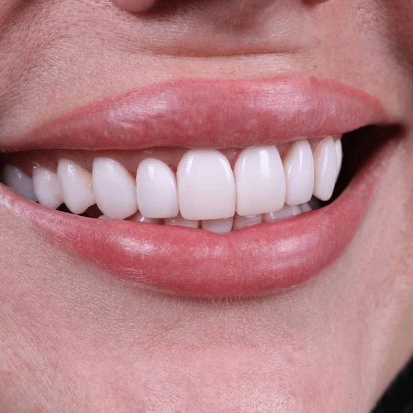 Confident smile after smile designing at our Sector 20 Kharghar clinic